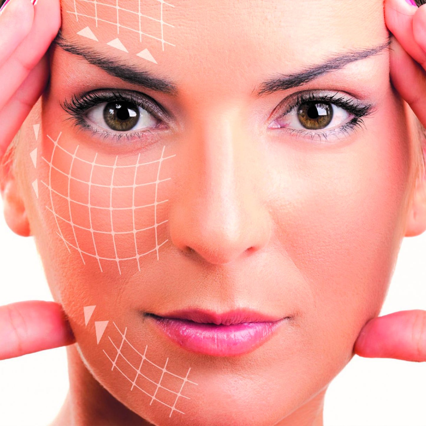 HIFU Facial por Zonas (óvalo/mentón, pómulo, frente, contorno de ojos)