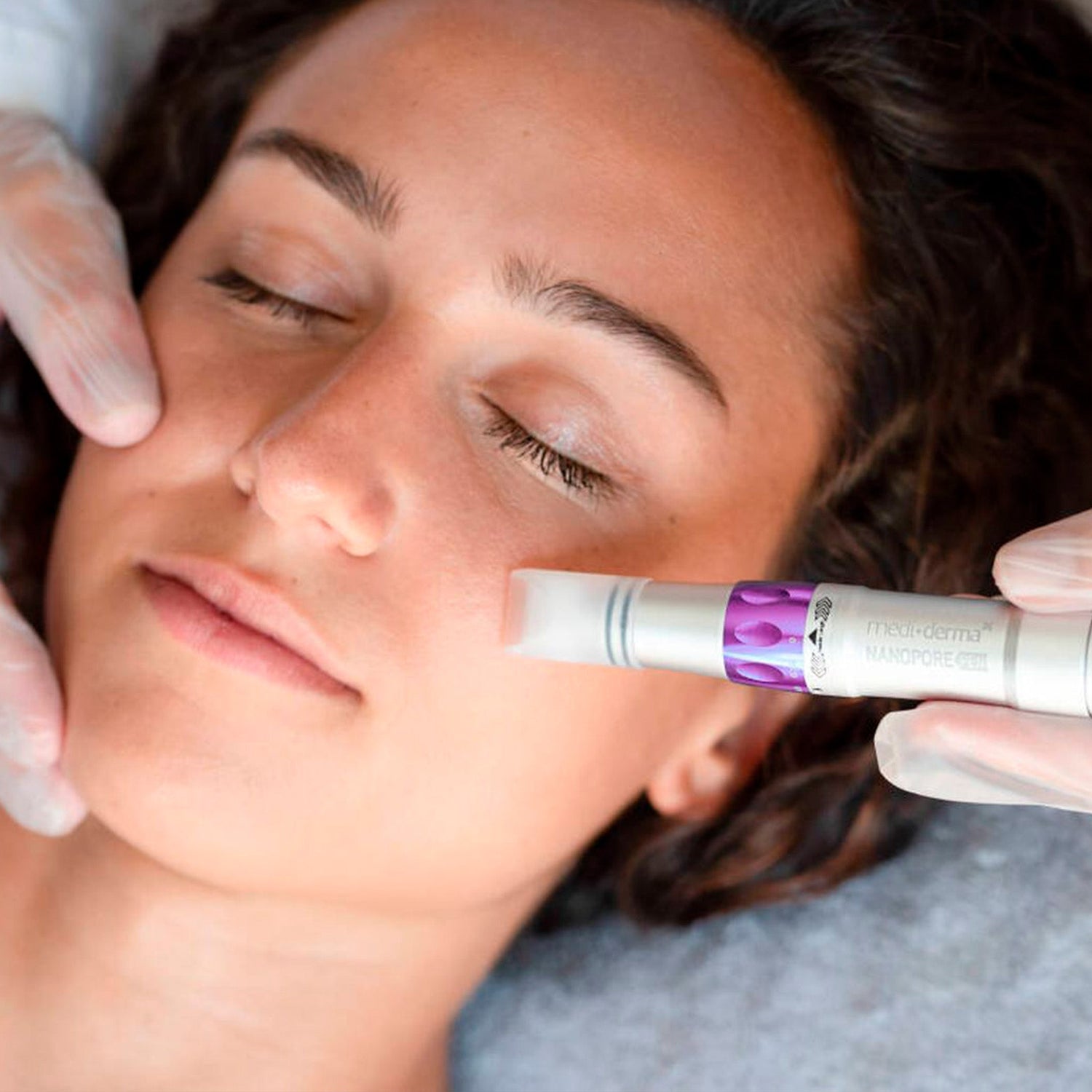 Faciales Despigmentantes