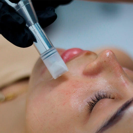 Nanopore Antiacné (micropunción seborreguladora)