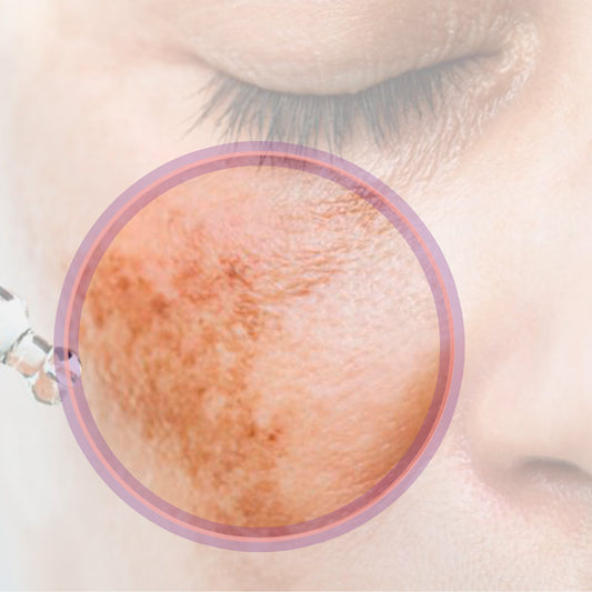 Programa Antimanchas Método Liz Castro (6 semanas)